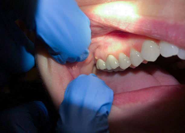Best Emergency Pediatric Dental Care in Thompson Falls, MT