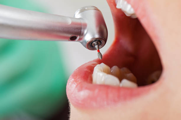 Best Urgent Dental Care for Toothaches in Thompson Falls, MT